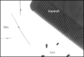 comb-lice-dandruff-sml